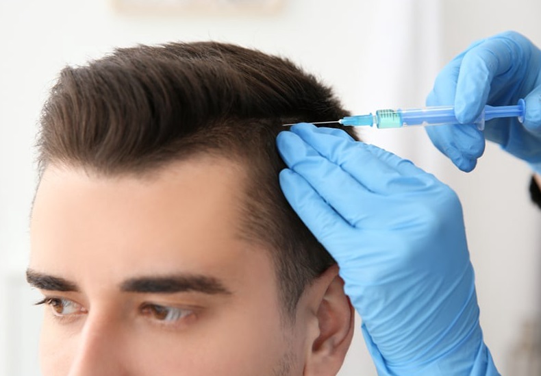 hair transplant treatment